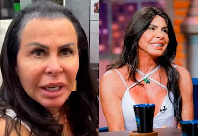 Gretchen emociona fãs ao desabafar sobre queda capilar: "Não tenho mais cabelo"