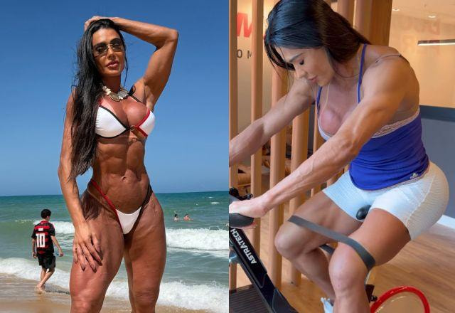 Gracyanne Barbosa atualiza fãs sobre recuperação após cirurgia no joelho