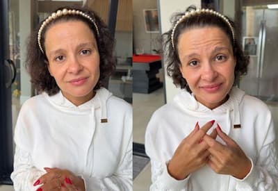 Maiara enfrenta doença sem cura que quase provoca perda total do cabelo; entenda