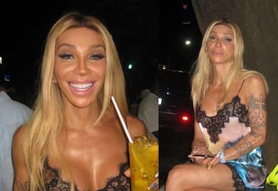 Maya Massafera passa por novo procedimento no queixo e relata dor após cirurgia