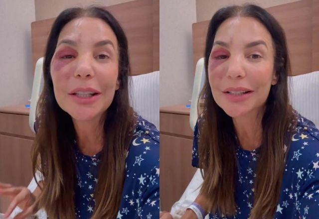 Daniel Cady atualiza saúde de Ivete após cirurgia e garante: 'Está bem'