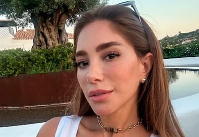 Romana Novais abre o jogo sobre procedimentos no rosto